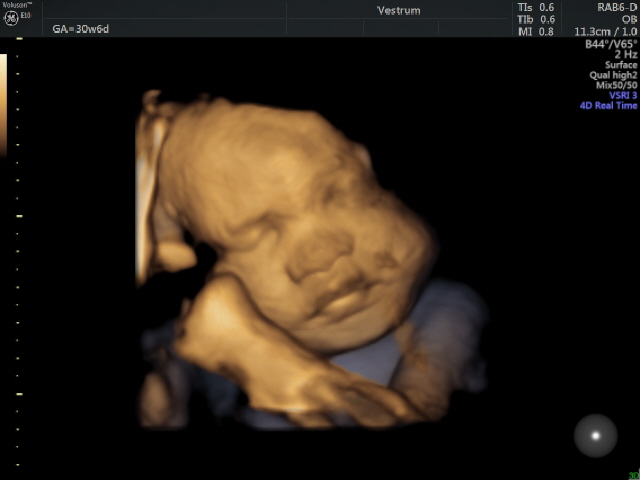 Third-Trimester-Scan.-3D-image-of-a-baby-at-30-weeks
